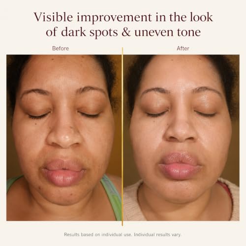 Vitamin C Face Serum for Dark Spots & Hyperpigmentation - Brightening & Hydrating, 30ml