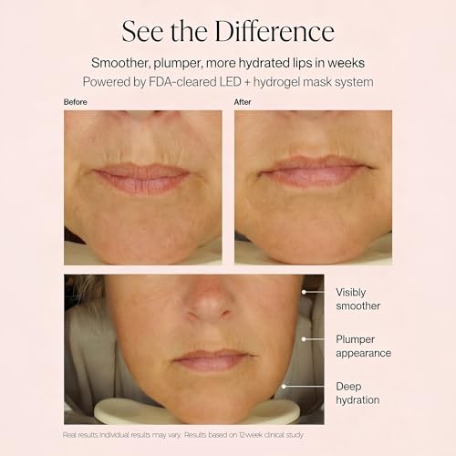 Metamorphosis LushLips Hyaluronic Acid Lip Mask with Centella | 5-Pack