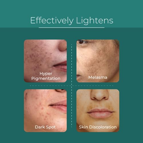 Probiotic Brightening Serum for Dark Spots & Age Spots - Fragrance-Free, Vegan Skin Care