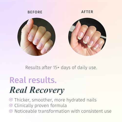 Duri Rejuvacote 2 Nail Growth Base & Top Coat - Pack of 2 for Fragile Nails