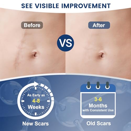 Silicone Scar Gel for Old & New Scars - 50ML Advanced Scar Removal Treatment