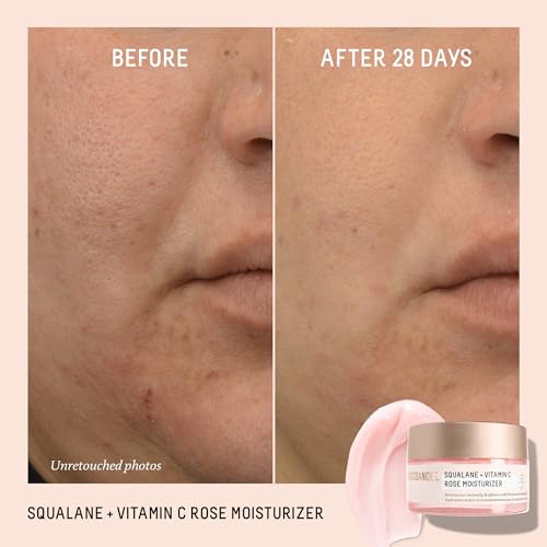 Biossance Squalane + Vitamin C Rose Face Moisturizer ? Antioxidant-Rich Day/Night Face Lotion ? Hydrates and Smooths Fine Lines ? Even Skin Tone & Reduce Discoloration ? For Radiant Skin, 1.69 Fl Oz