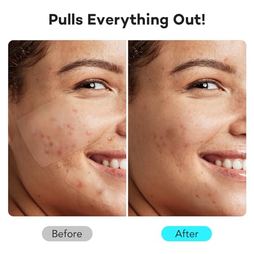 Eco Lips Organic Sugar Lip Scrub, Plumping Lip Mask & Overnight Intensive Lip Mask for Chapped Lips 4-Pack (0.25 oz. each) ? 100% Natural