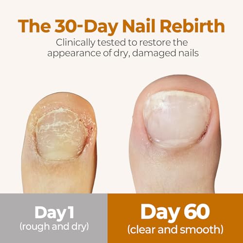 TuneTune Fermented Korean Cuticle Oil 8ml - Lightweight Nail & Cuticle Moisturizer - Pack of 1