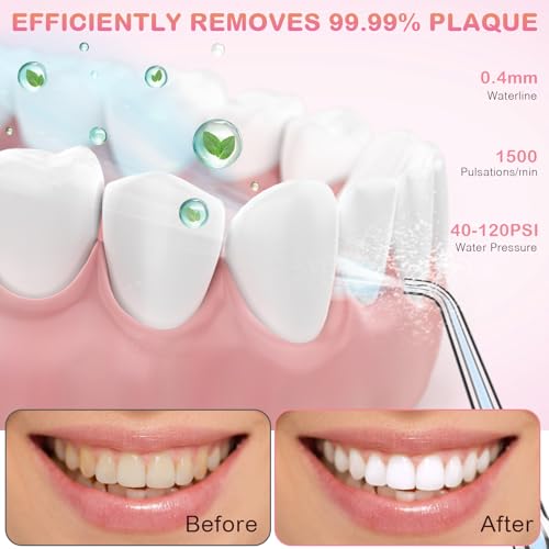 Portable Water Flosser with Travel Case - Rechargeable IPX7 Waterproof Oral Irrigator Pink - 5 Jet Tips & 4 Modes