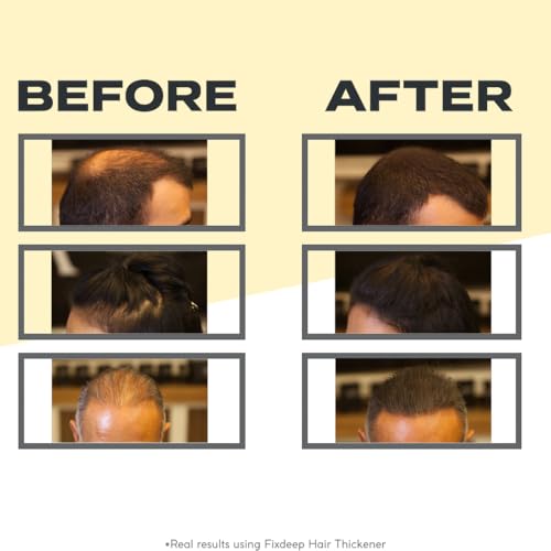 Fixdeep Light Brown Hair Fibers - Waterproof Hair Thickener for Thinning & Bald Spots, 14g