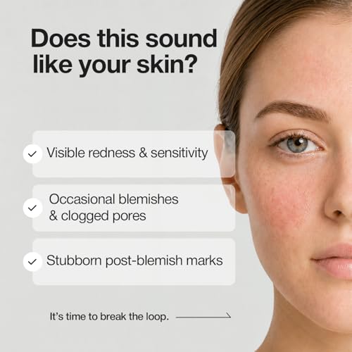 Azelaic Acid Serum with Niacinamide & Hyaluronic Acid - Brightening Face Treatment 1 oz