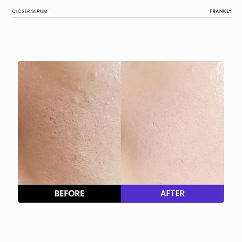 Frankly Closer Serum Jumbo 2 Fl Oz Pack of 2 - Pore Minimizer, Anti-Aging, Hydrating Vegan Serum