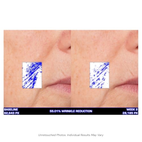 Serious Skincare Ultra-Mare Marine Infusion Facial Serum - Collagen, Cell Turnover, Plumper Skin, Niacinamide, 2 oz