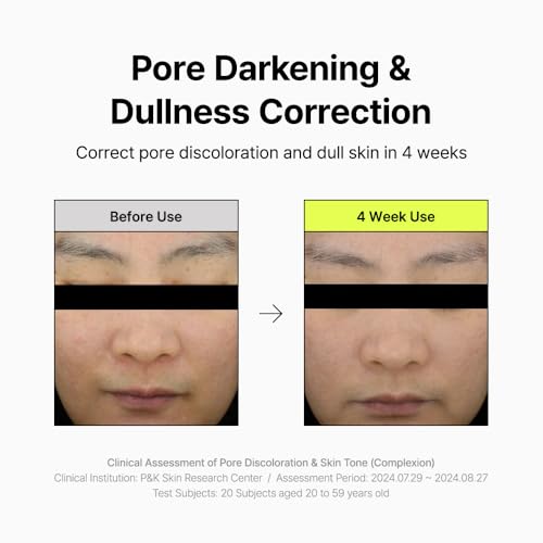 By Wishtrend Vitamin A-mazing Bakuchiol Serum for Pore Care & Skin Revitalization – 1 Fl Oz