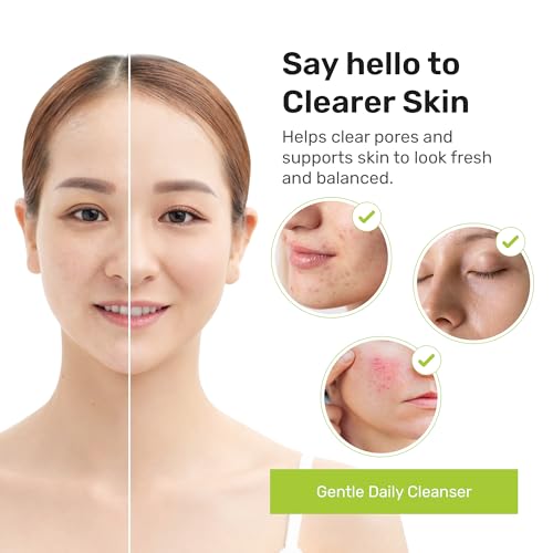Organic Lemongrass Face Wash for Acne-Prone Skin - 6 oz, Gentle Daily Cleanser with Natural Botanicals