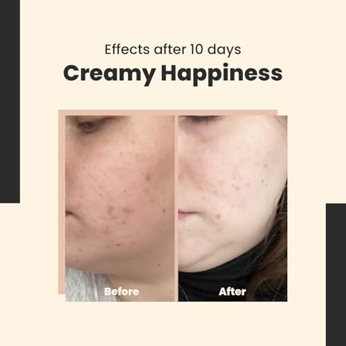SkinTra Creamy Happiness Retinal Emulsion 0.1% for Anti-Aging & Hydration