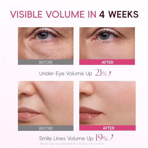APBM Volufiline Serum France SEDERMA, Plumping Serum for Face, Multi-Peptide, Niacinamide, Collagen, Visible Volume for Under-Eye and Smile Lines, For Fuller, Radiant-Looking Skin, 1.01 fl oz