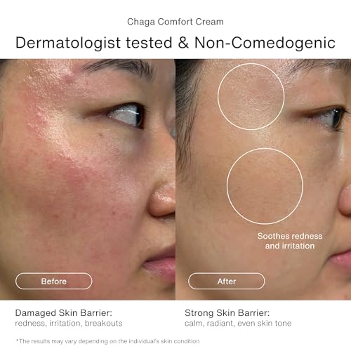 Korean Skincare Set | Under-Eye Care with Zen Reset Eye Patches & Skin Barrier Care with Chaga Comfort Cream, Self Love Duo