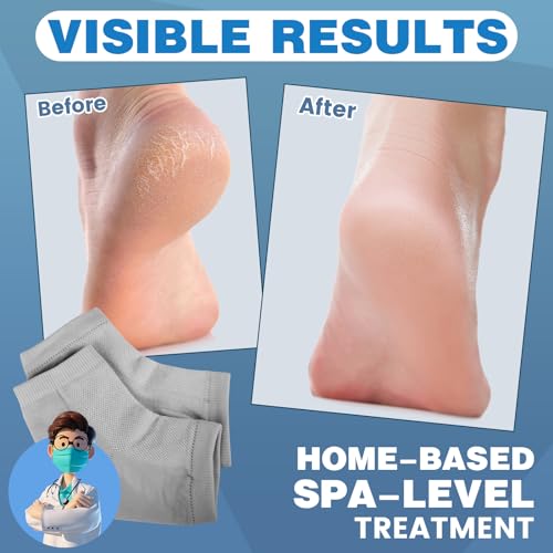 Moisturizing Toeless Heel Socks - Cracked Heel Repair, 6 Colors, 18 Pairs