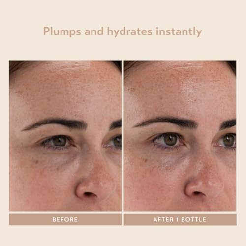 Moisture Boost Plumping Serum for Face - Hydrating & Bouncy Skin
