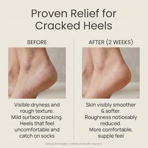 SEACRET Dead Sea Mineral Foot Cream 3.4 fl oz / 100 ml - Soothing & Moisturizing, Vegan & Cruelty-Free