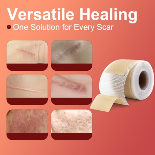 Graham Spa Essentials Esthetic Wipes, 2 Inch X 2 Inch