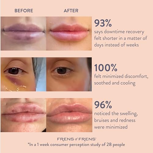 Aesthetic Aftercare | TAKE After CARE Arnica & Bromelain Gel for Bruising, Swelling after Fillers, Cosmetic Injections | Cooling Depuff Serum Face Roller | 100% Vegan (30ml)