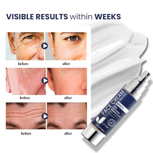 6-in-1 Men’s Face Cream with Collagen, Hyaluronic Acid & Vitamins - 1.7 oz - Dark Spots & Eye Bags Treatment