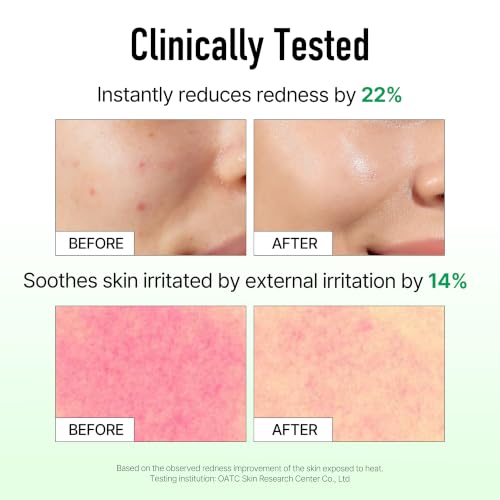 Korean Melatonin Serum with Centella Asiatica & Ceramides for Hydration & Skin Recovery