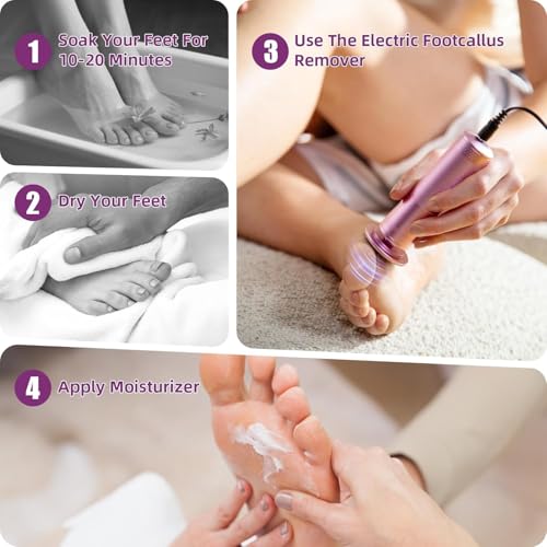 Electric Foot Callus Remover: Diamond-Coated Foot File with 3 Adjustable Speed - 60pcs Sandpaper Discs, Detachable Washable Head - Professional Pedicure Tools for Women