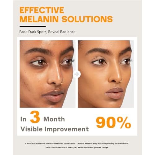 Turmeric Kojic Acid Soap for Dark Spot, Brighten Skin Face and Body Cleanser with Shea Butter, Vitamin C, Moisturizing Natural Skincare£¨2pcs£©