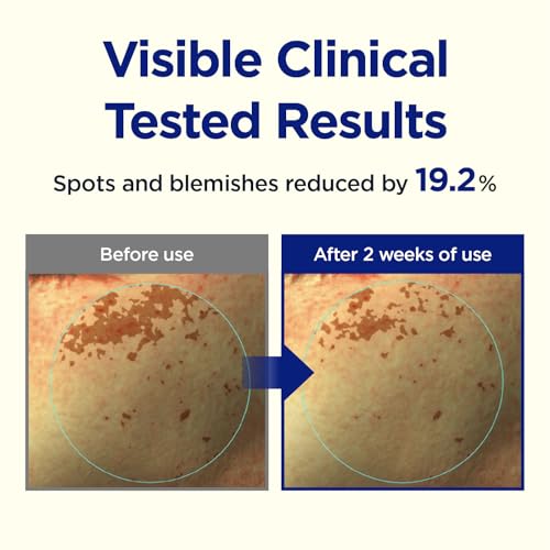 CKD Vita C TECA Triple Blemish Under Eye Gel Patches - Large Hydrogel for Dark Spots