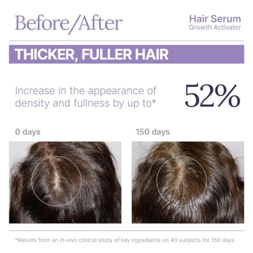 Keranique Hair Growth Serum for Women 1 Fl Oz - Thinning Hair & Density Booster