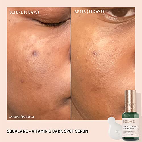 Biossance Squalane + Vitamin C Dark Spot Serum 10% Vitamin C, 1.01 Fl Oz