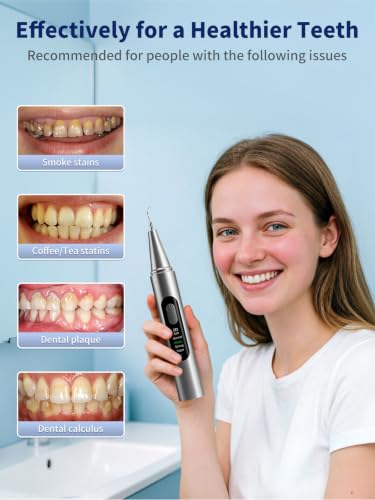 Teeth Plaque & Tartar Remover with HD Camera - Dental Cleaning Kit with LED Light & 5 Modes