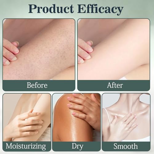 Skin Fold Barrier Cream, 2PCS Skin Fold Care & Chafing Support Cream, Fast-Drying Non-Greasy Formula for Friction-Prone Areas, 3.53 oz