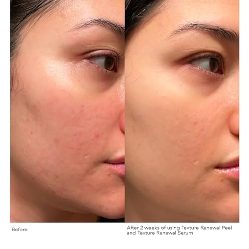 Dr. Dennis Gross Advanced Retinol + Ferulic Texture Renewal Serum ? Anti-Aging Formula to Smooth Texture, Boost Radiance, and Minimize Fine Lines & Wrinkles, 1 oz