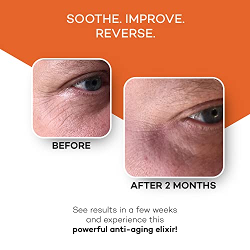 Anti-Aging Eye & Face Serum for Wrinkles & Fine Lines - 15mL