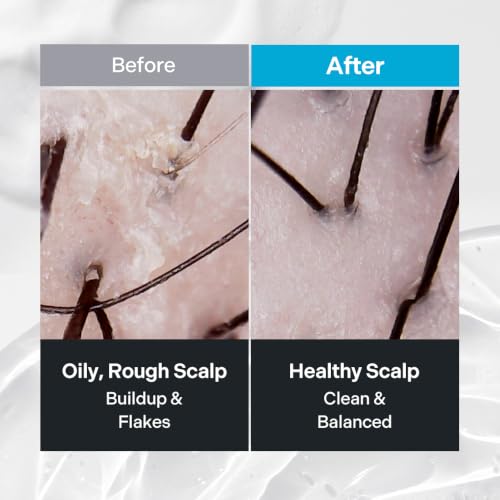 Korean Scalp Scrub with Sea Salt and Mint - Deep Exfoliating Hair & Scalp Treatment