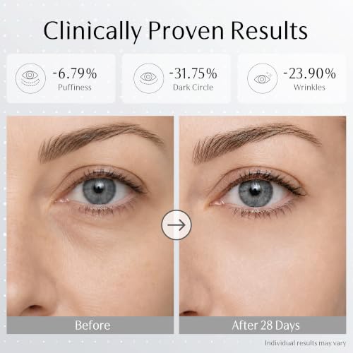 Exosome PDRN Eye Cream for Dark Circles & Wrinkles - 0.88 oz with Micro-Current Technology - Firming & Anti-Aging