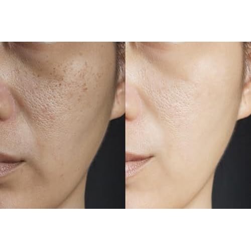 Vitality Precision Skin Vitamin C Pumpkin Enzyme Mask