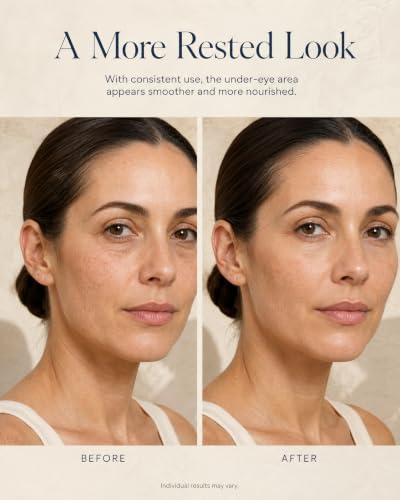 Hydrating Eye Cream with Caffeine, Retinol & Aloe for Dark Circles