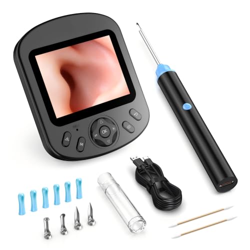Cklvu Smart Digital Otoscope Ear Camera with 2.8" Screen – Plug & Play, Black (Variation: Black)