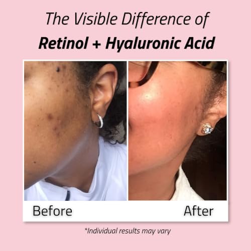 Retinol Face Moisturizer with Hyaluronic Acid - 4oz Night Cream - Paraben-Free