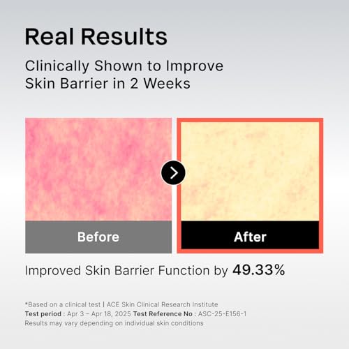 Ceramide Face Moisturizer with Hyaluronic Acid & Panthenol - Sensitive Skin Repair