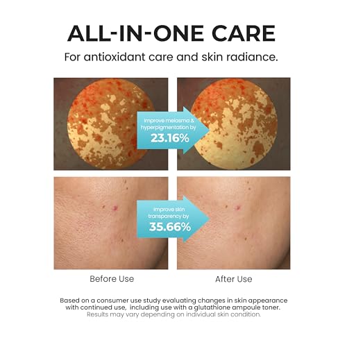 [SKIN&LAB] Glutathione Radiance Cream 1.69 fl oz | Cellfusome Glutathione 100,000ppm | Face Moisturizer for Dry and Sensitive Skin
