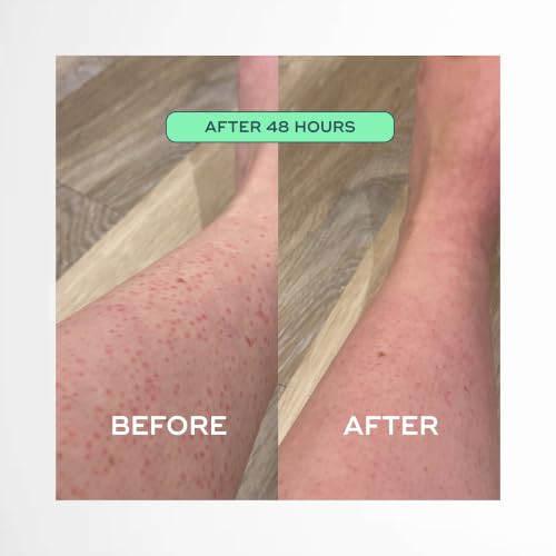 Luna Daily Ingrown Hair Oil 1 Fl Oz - Razor Bump & Redness Relief, Pack of 1