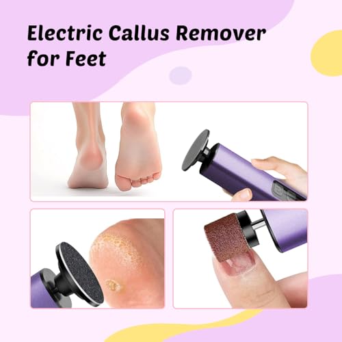Dolcevitae Deep Lavender Professional Foot Callus Remover 9-Speed, Nano Glass Disc, Rechargeable with Discs & Case