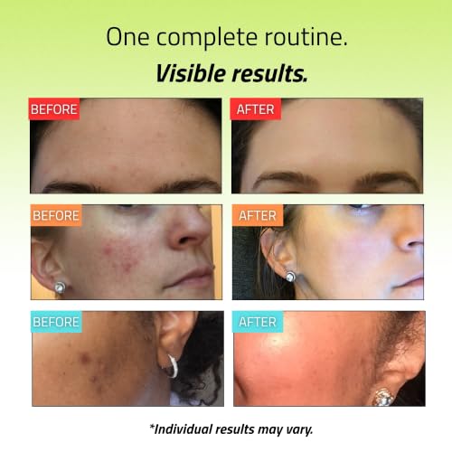 YEOUTH Teen Skincare Set 4-Pack for Clearer Skin - Gift for Teen Girls & Boys