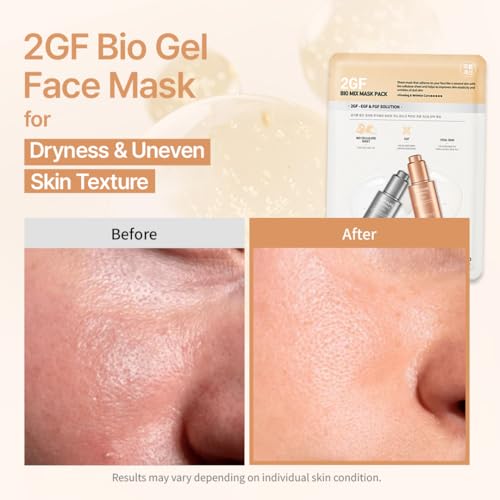 Pregnancy Safe 2GF Bio Gel Face Mask Elasticity, Deep Hydration Elasticity, Plumping Improvement, Glow Skin, Growth Factor (EGF FGF) Korean Skincare (10 sheets), Valentines Day Gifts for Her