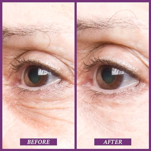 PRAI Beauty Ageless Eye Tight Uplift Serum, Anti-Aging and Hydrating Eye Serum, For Instantly Ageless Brow and Eyelid Area, 0.5 Oz