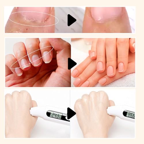 Handmade Christmas Press on Nails Thick Short Square False Nails with Xmas Reindeer Santa Claus Candy Cane Designs Muti-Layer Gel False Nails Full Cover Glitter Acrylic Nails for Women (Size M)