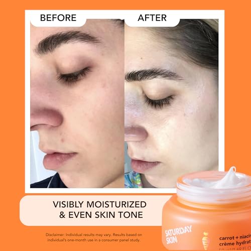 Moisturizer with Carrot & Niacinamide for Skin Barrier - 50ml Carrot Cream