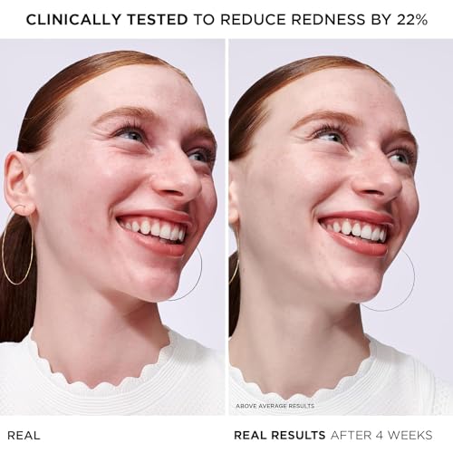 Calming Face Serum for Redness Relief with Colloidal Oatmeal - 24H Hydration, Sensitive Skin Care